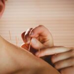 Conocer sobre Medicina China: ¿Qué es la acupuntura?
