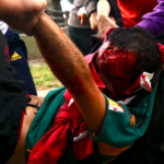 Un fotógrafo lucha por su vida tras ser agredido por la policía en la marcha de jubilados